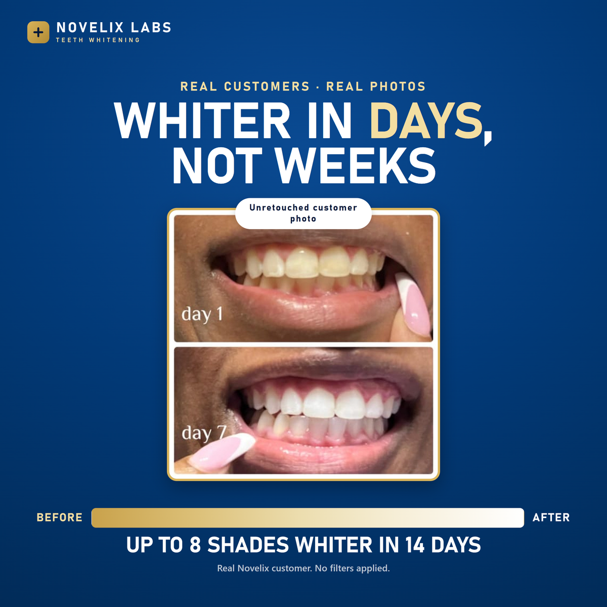 Whiter Teeth in Minutes · Novelix™ Pro Gold Whitening Pen