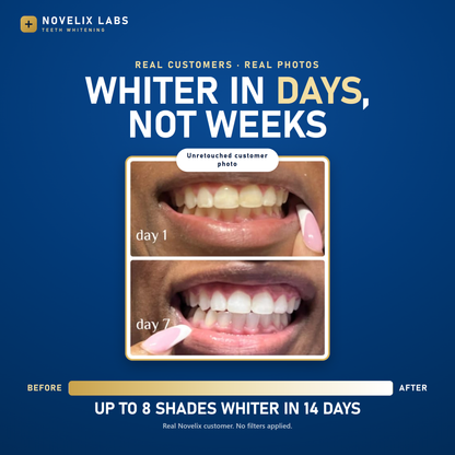 Novelix™ Pro Whitening Pen